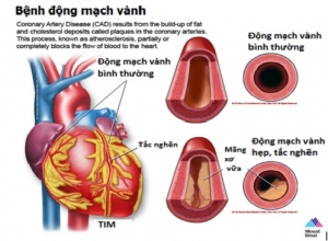 Động mạch vành là gì và chức năng của nó?